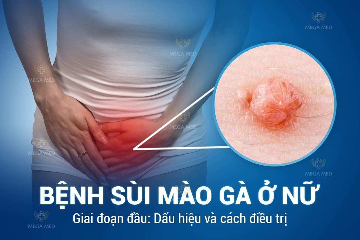 Sùi mào gà ở nữ giai đoạn đầu